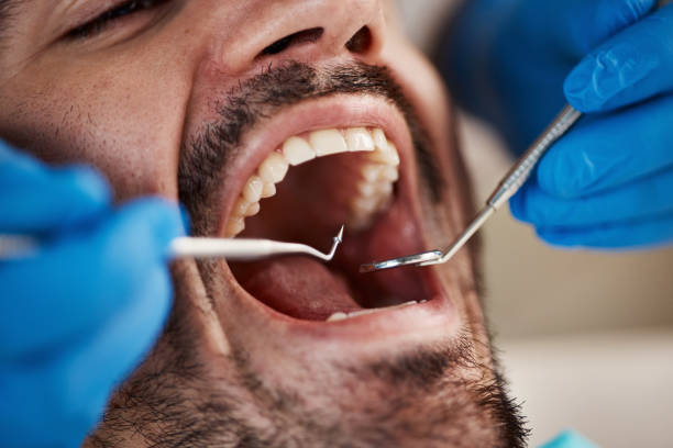 Best After-Hours Emergency Dentist in Sistersville, WV